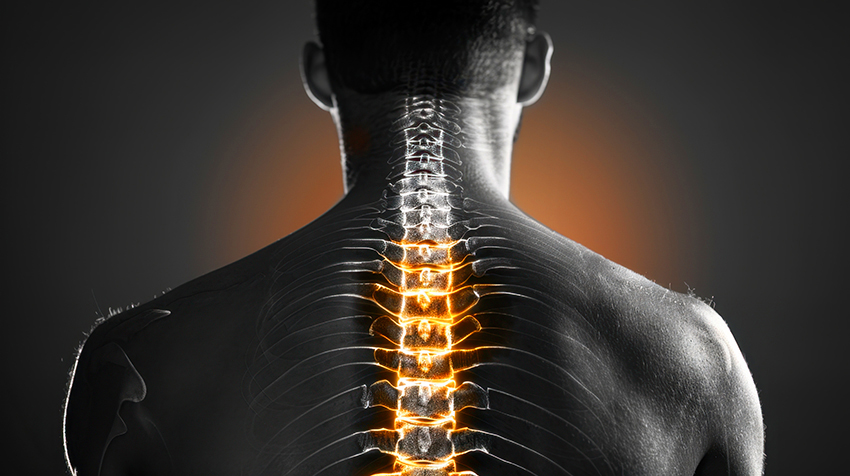 Spinal Decompression Disc Herniation Treatment Forked River, Ocean County, NJ